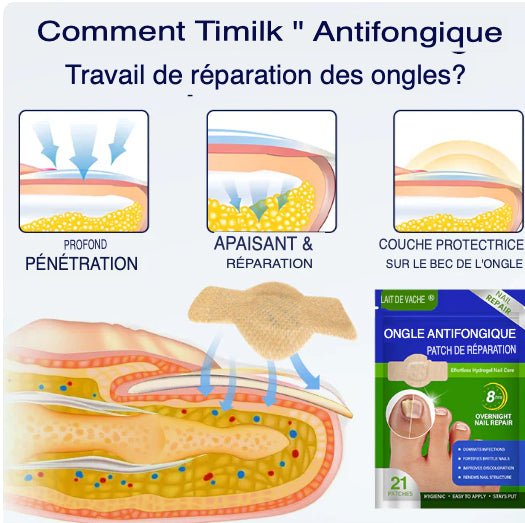 SleepCure Patch réparateur antifongique pour les ongles