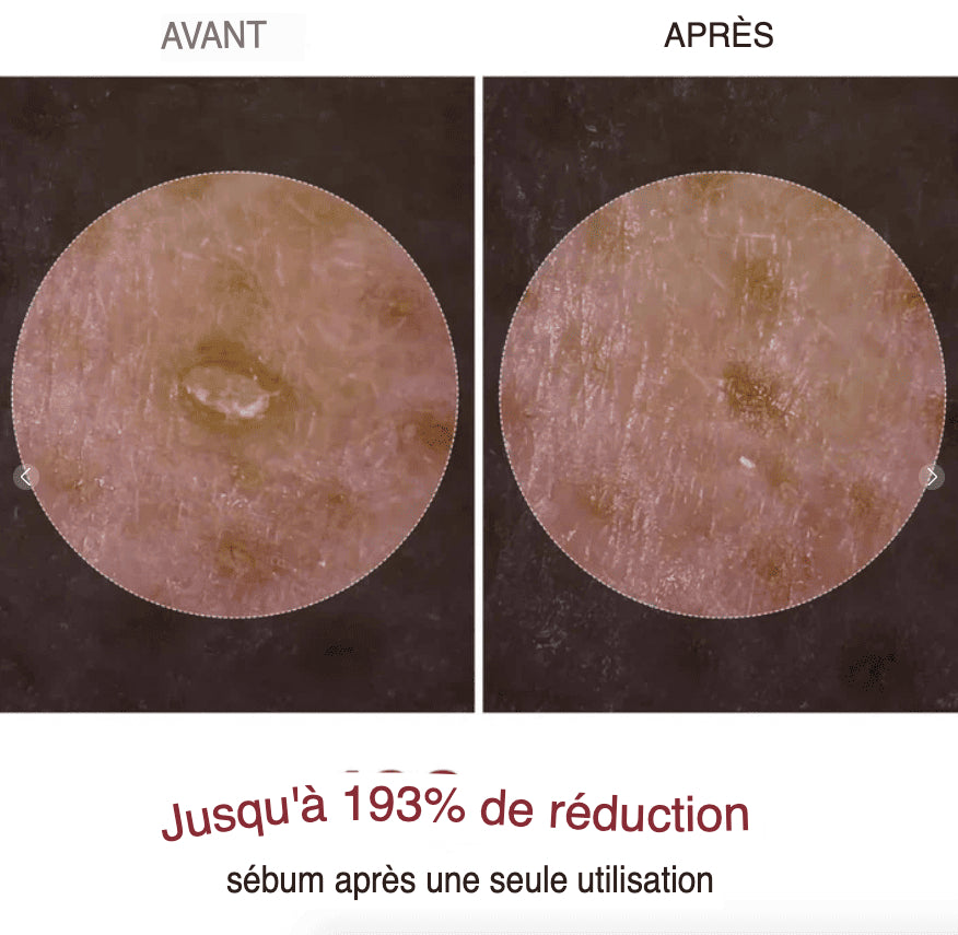 Dr Melaxin™ “Le peeling coréen liquide qui renouvelle votre peau en 24h