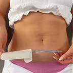 Laniska Patch Abdominal Transparent Sculptant