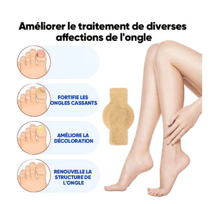 SleepCure  Patch réparateur antifongique pour les ongles