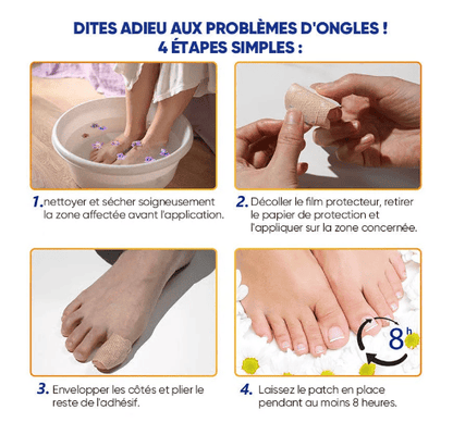 SleepCure  Patch réparateur antifongique pour les ongles