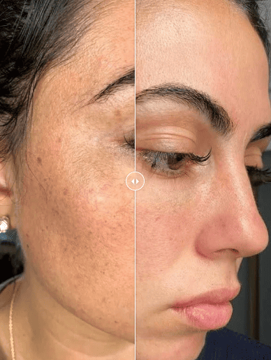 Dr Melaxin™ “Le peeling coréen liquide qui renouvelle votre peau en 24h