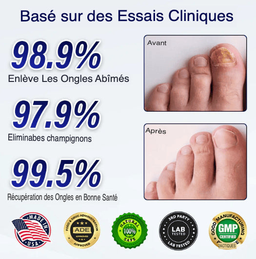 SleepCure  Patch réparateur antifongique pour les ongles