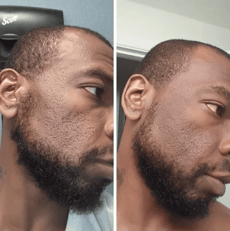 Dr Melaxin™ “Le peeling coréen liquide qui renouvelle votre peau en 24h