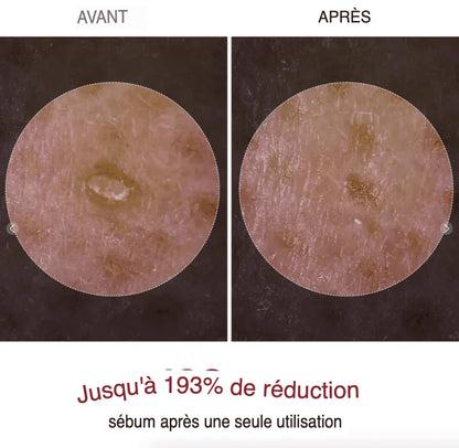 Dr Melaxin™ “Le peeling coréen liquide qui renouvelle votre peau en 24h