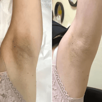 Dr Melaxin™ “Le peeling coréen liquide qui renouvelle votre peau en 24h