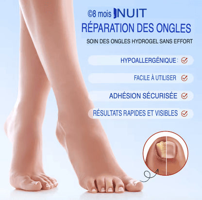 SleepCure  Patch réparateur antifongique pour les ongles