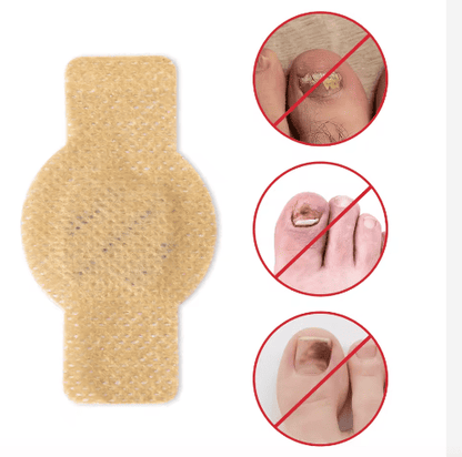 SleepCure  Patch réparateur antifongique pour les ongles